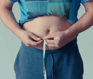 Tratamiento de la Obesidad